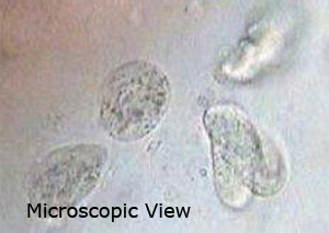 chilodonella-02.jpg chilodonella-02.jpg